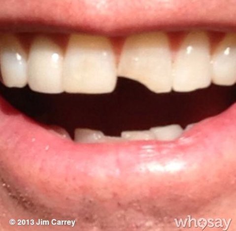 jim carrey dumb and bumber chipped tooth