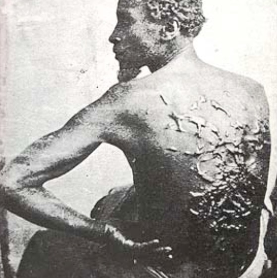 slave scar