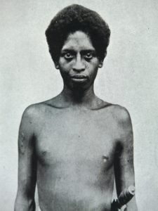 A YOUNG BLACK MAN IN THE PHILLIPINES (2)