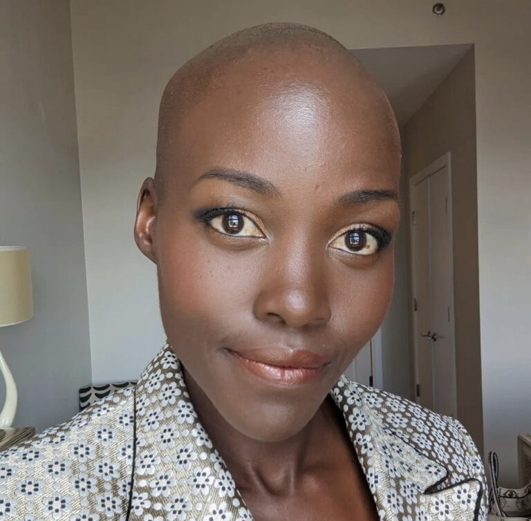 Welcome To The Bald Head And Loving It Club Lupita Nyong O Shocks