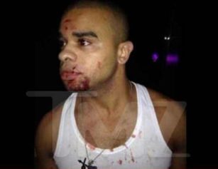 Raz B Gets Hit in Face With Bottle in Chinese Nightclub Brawl