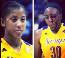 Candace Parker's Celebration Leaves Teammate With Bloody Eye