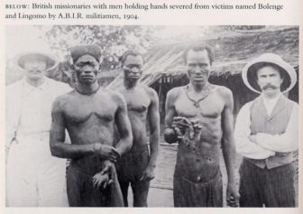 king leopold cut off congolese hands