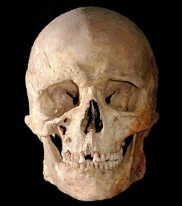 Skull of mesolithic hunter-gatherer