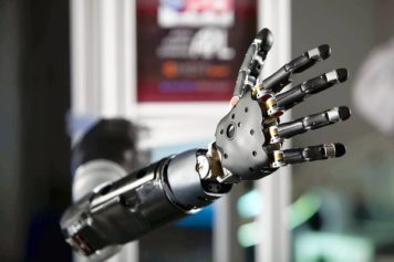 Mind-Controlled Prosthetic Arm Gets FDA Approval