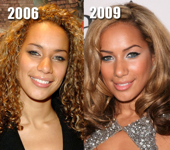 12 Black Celebrities Who Have Been Accused of Getting Nose