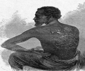 Enslaved man cuts off hand during slavery