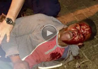 NSFW: Graphic Footage Captures Law Enforcement Viciously Beating UVA Student Allegedly Over His ID