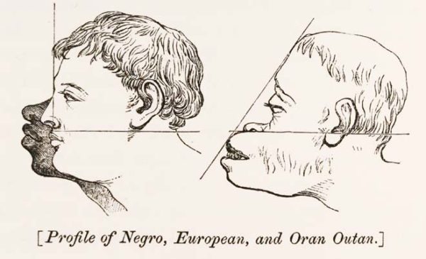 Scientific Racism