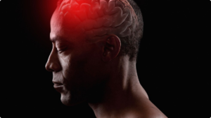 060413-health-brain-aneurysm-head-injury-concusion-2