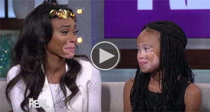 The Moment When This Young Girl with Vitiligo Meets Her Celebrity Idol, April Star, Is Absolutely Heartwarming