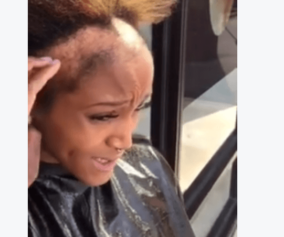 Atlanta Woman Bravely Reveals Damaging Impact Weaves and Braids Can Have on Black Women's Hair