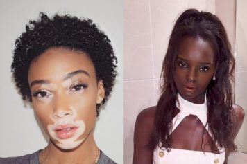 Winnie Harlow Draws Social Media's Wrath with 'Joke' About Another Model's Natural Hair