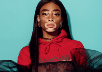 Winnie Harlow Unwilling to Continue Being Spokesperson forÂ Vitiligo: 'You Can Do Your Research'