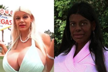 German Woman Turning Heads for Extreme Plastic Surgery to Become a 'Black Woman'