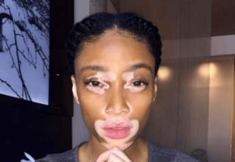 Winnie Harlow Responds to Accusations of Body Shaming: 'That's Something I Would Never Do'