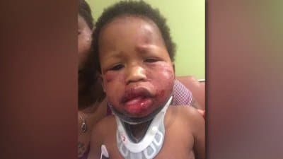 Indiana Day Care Blames Baby's Injury On Another Child FSS Does Emergency Shut Down