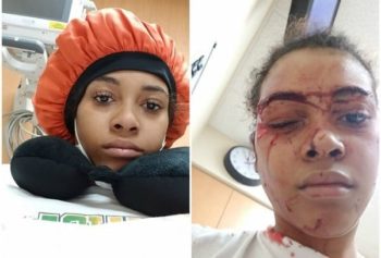 St. Louis Woman Attacked
