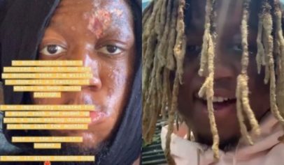 Rapper OG Maco Reveals He's Had Skin-Eating Disease That Nearly Cost Him His Entire Face, Did Cost Him His Loved Ones
