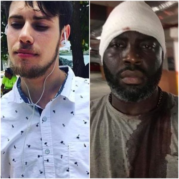 White man with black man injured