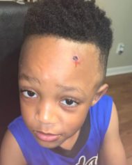 Boy with painted bullet wound in head