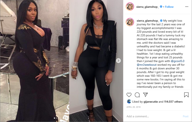Sierra Gates Before And After Surgery