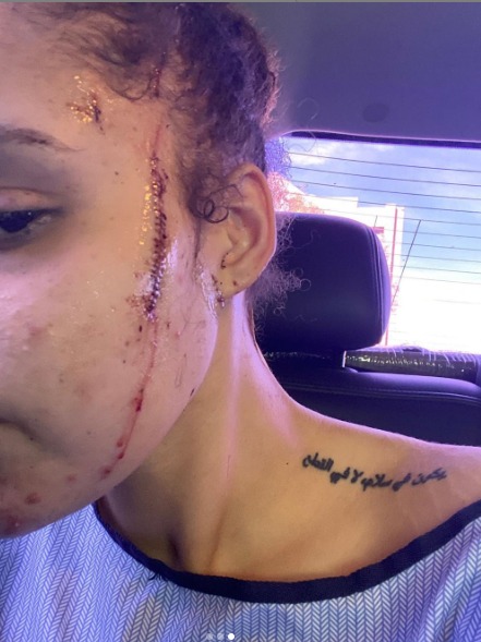 Yasmine Jackson, granddaughter of Joe Jackson, stabbed seven times on the neck in hate crime