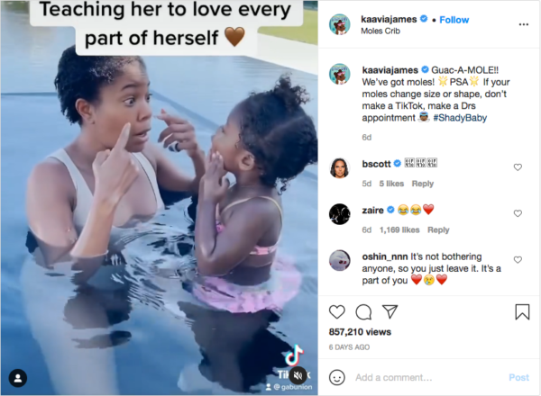 Gabrielle Union Teaches Her Daughter To Love Every Part Of Herself Following An Insightful Discussion About Beauty Marks