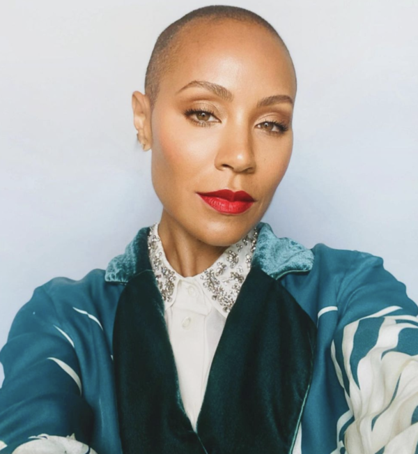 It Just Showed Up Like That': Jada Pinkett Smith Shows Effects of Alopecia
