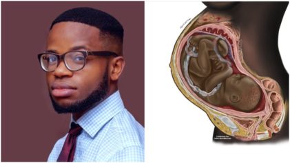 Never Seen a Black Fetus Illustrated, Ever': Medical Student Made 'Deliberate' Decision to Illustrate Anatomical Images Featuring Black Bodies