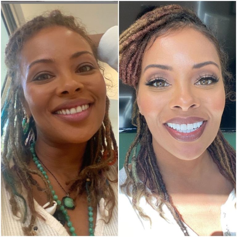 ‘why Mess With Perfection Eva Marcille Debuts New Smile Fans Have
