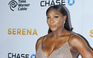 This Is The Serena We Know and Love': Serena Williams Seemingly Hits Back at Bleaching Rumors with New Photo