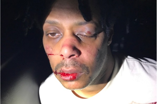 Premeditated Act of Revenge': Minneapolis Police Officers Beat Man to a Pulp, Allegedly Plant Drugs Near His House After He Complained, Lawsuit Claims