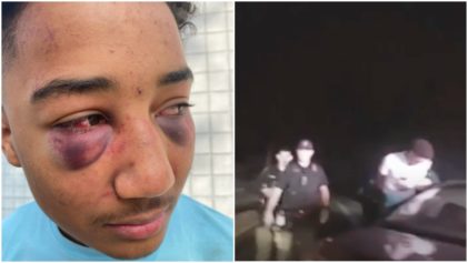 A Helpless Teenager': Grand Jury Indicts Former Stockton Police Officers In Beating of Black Teen That Left Boot Print on His Face