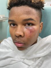 ?The Student Attacked Me': Educator?s Fight with Student Lands Both In Hospital as Teacher Is Charged with Assault, Fired By School Board