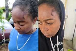 You're Hitting My Head! Help!': California Woman Filming Arrest In Her Own Yard Is Left with Scars After Police Manhandle Her for Obstruction Federal Lawsuit Follows