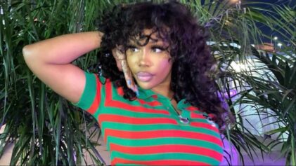 SZA addresses the past claims that she received facial surgery.