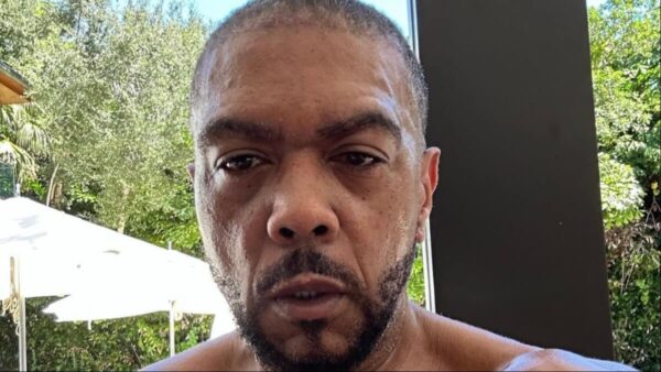 Timbaland shows off new hairline months after hair transplant surgery.