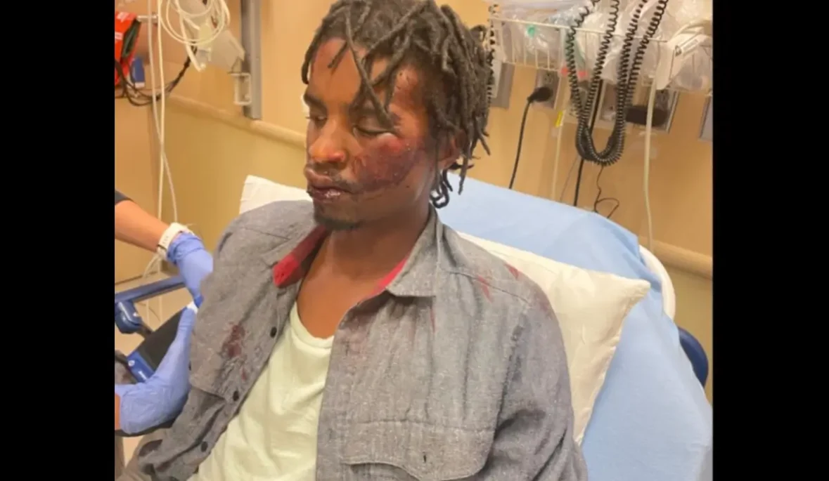 Cops Beat Homeless Veteran, Joke About It After. Now, Denver Must Pay Him $1.2M, But Officers Remain on the Job