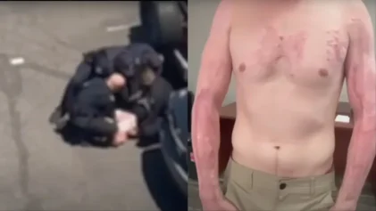 Innocent Phoenix Man Who Suffered Severe Burns After Cops Pinned Him On Hot Pavement In 114-Degree Weather Takes Legal Action