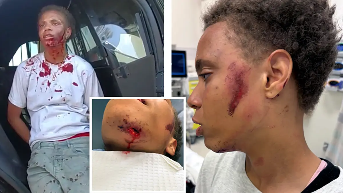 ‘My Chin Was Still Leaking’:  California Cop Slams Black Teen on the Ground When She Was the Victim, Not the Suspect. Now She Want Him to Pay